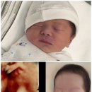 크린팩(주) - 괴산군 | 1주차 신생아 육아일기와 출산후기 그 사이 어디쯤 (미래아이산부인과 제왕절개 후기, 출산후 몸무게 변화)
