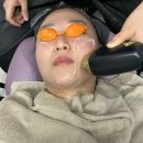 로데오사우나 | 압구정로데오피부과 티타늄리프팅 후 통증 효과 후기