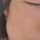 미백에센스 닥터제이에스케이
