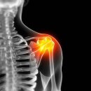 통증지압케어센터 이미지