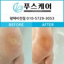 평택발관리 비전동 발각질 푸스케어에서 아기발이 되었어요