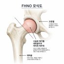신동화 | 한쪽 고관절 수술을 했는데, 반대쪽도 수술하게 되었습니다｜9살 포메라니안 FHNO 후기