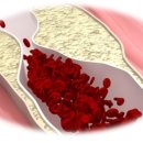 소리청한의원 이미지