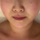 창원 중동 에스테틱샵 [더맑은스킨] 홍조 진정부터 속수분까지 제대로 케어받고 온 찐 후기