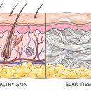 닥터본성형외과의원 | 선릉역성형외과 재수술 고민? 20년차 전문의가 알려드리는 핵심 3가지