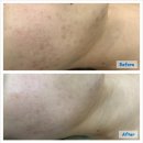 미니스톱 수유대한점 | 수유역 피부관리<마이스킨테라피>-부위별 트러블, 여드름 원인부터 파악하자