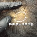 강디자인 | 부산두피문신 에테르노에서 자연스러운 SMP 디자인 상담받은 후기