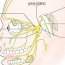햇빛보면 재채기 햇빛 알레르기 증상 검사 아츄증후군 이미지