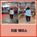 이레알찬정형외과 | 어깨 재활은 이레알찬 정형외과로 오세요~!