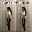 원동빌딩 | 원주 원동 필라테스가 말하는 체형 교정의 진실 | 거북목 라운드 숄더 방치하면...