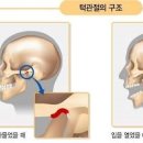 턱관절 통증 원인 및 턱에서 나는 소리 자가진단 방법 이미지