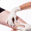 [순천하지정맥류/순천]하지정맥류의 치료시기 -순천하지정맥류 아나파적맥통증의원 이미지