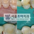 서울조아치과 이미지