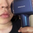 홈유레카 | 20대의 홈케어로 이중턱 없애기 _ 홈모드 써마 리프트 한달 사용 후기 내돈내산