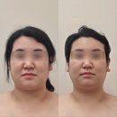 반아뷰티 | 전주마사지 & 왁싱, 난임관리까지 가능한 ‘반아뷰티’에서 받은 작은 얼굴 관리 솔직후기
