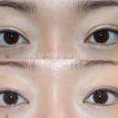 뷰라밸성형외과의원 이미지