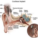 중앙보청기 수원지사 이미지