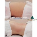 젤라 피부관리