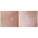 보나클비누,4주사용 리얼후기