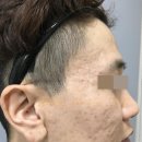 셀렉트피부과의원 네이버블로그