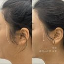 리그로브왁싱 이미지