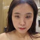 정관장홍삼남천점 | [남천동 피부관리] 단아한에스테틱 파워트리 피부관리 후기