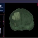 이안헬스케어 이미지