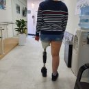 성화의족의수보조기 | 서울보조기 의족 맞출 때는 더조은케어