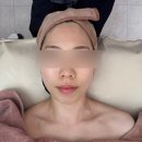 온리피부관리 | 춘천 웨딩 관리 피부관리샵 온리뷰티 하이푸관리 후기