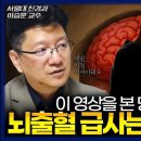 이 영상을 본 당신에게 뇌출혈 급사는없습니다 이미지
