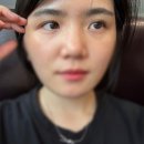 고급 독자가 될 결심 | 리아이프팅 1차 후기! 눈썹실리프팅 &amp; 눈꺼풀리프팅으로 생기 되찾았어요!