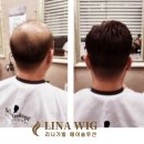 비앤에스 | 청주가발 리나가발&amp;비앤에스 방문 후기, 자연스럽고 편안한 맞춤 가발