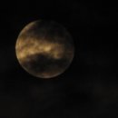 정이안한의원 이미지