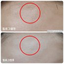 아로마연구소쁘띠꾸앙 | 수면주름팩 보톡스 필러 당신이 잠든 사이에 ~ 홈필러 필로그램 1차 오픈 뷰티윤 장산역피부관리