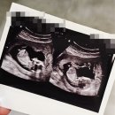 채난희산부인과 네이버블로그