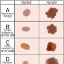 검은 점이 갑자기 커진다면? 이미지