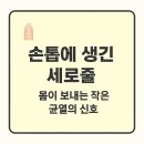 작은손톱 이미지