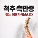 척추 측만증(Scoliosis) 구조·원인·곡선·연령별로 정리한 임상적 이해 이미지
