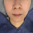 바른메드 | 트랜스킨M 바쿠메드 2차 후기ㅣ건조감이 달라진 피부 변화 기록