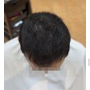 정수리 갈라짐과 텅 빈 앞머리 탈모 고민, 토탈 탈모교정 성형펌 하나로 10년이상젊어지는 방법/ 괘법사상감전주례하단명지녹산신호화명장유동 이미지