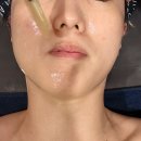 P.T의 신 | 권선동 윤곽관리 아미아 이마트 수원점 동안 윤곽관리 물방울 초음파 솔직후기