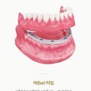 변치과의원 네이버블로그