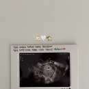 (주)쓰리아이 | 5w-9w 임산부일상 👶🏻 (아기집확인/난황확인/쓰리라인임테기역전/심장소리확인/보건소임신초기검사/태명...