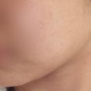 블루밍의원 이미지