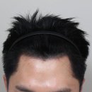 대치초등학교 | 강남두피문신 잘하는곳 찾는다면? (유지기간, 가격, 리터치, 후기)