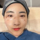 레드게임랜드 | 부산 서면 성형외과 유명한 곳 튠페이스로 불독살, 팔자주름 해결하고 브이라인 된 후기