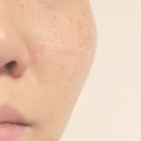 맑은얼굴피부과의원 | 얼굴 기미 보고 논산 피부과 의원 전문의 찾은 후기