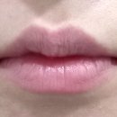 미케이의원 | 강남역 보톡스 필러 잘하는 곳, “미케이의원” 승모근보톡스 입술입꼬리필러 후기