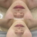 춘천피부관리 지엔뷰티 에스테틱 후기