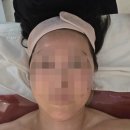 봉선동 피부관리 이엘에스테틱, 1회 관리로 턱선이 달라진 써마웨이브 솔직 후기